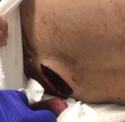 Actress Elizabeth Hurley posts an image of the damage caused to her nephew in a knife attack.