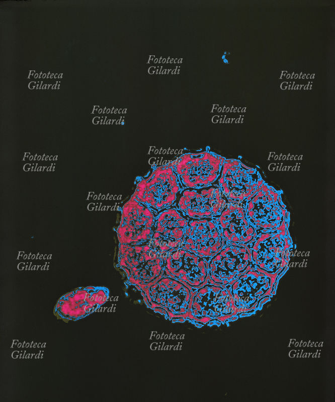 COLORI ARBITRARI elaborazione cromatica di una struttura sferica naturale al microscopio. Toni di ciano e magentasu fondo nero. Il sofisticato procedimento di colorazione creativa arbitraria è stato ideato dall\