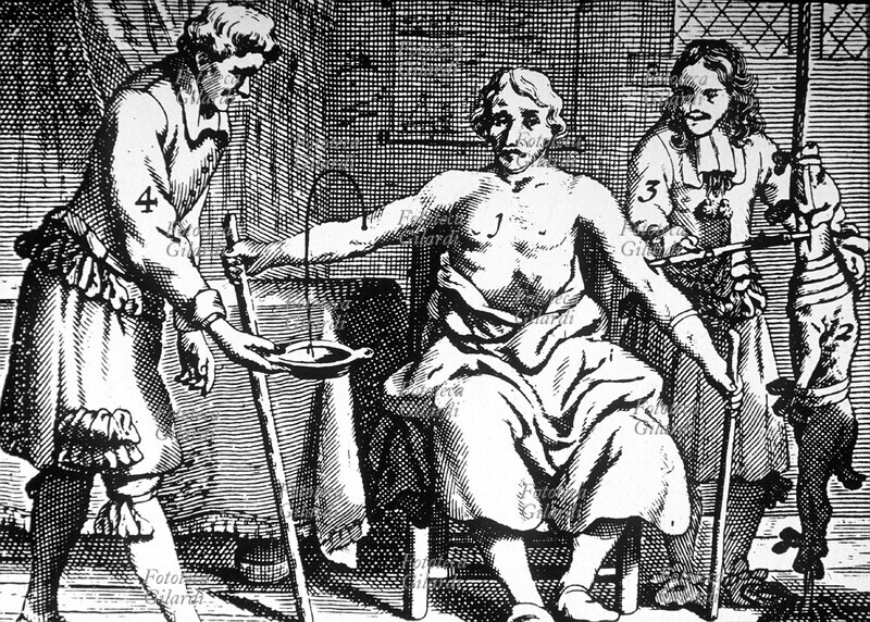 MEDICINA La prima trasfusione di sangue, operata con successo nel 1667 da Jean-Baptiste Denis. Si immette sangue d\