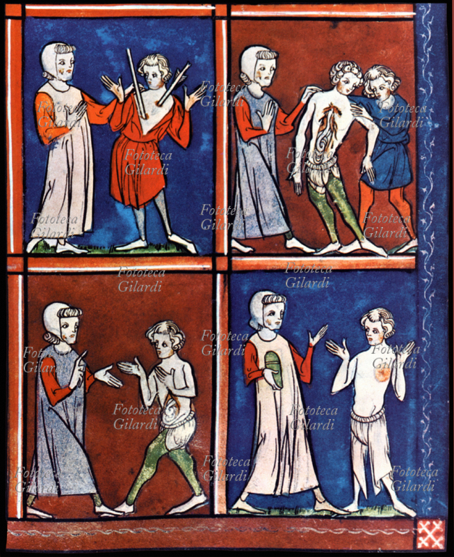 MEDICINA come si estraggono due lance dal petto, come si apre il torace e l\