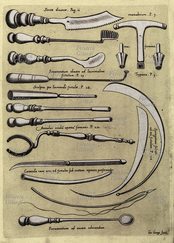 MEDICINA strumenti per chirurgia. Tavola da trattato di Fabrizio di Acquapendente \