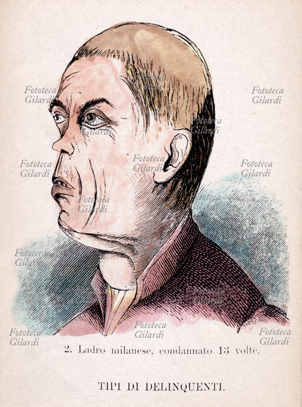 Cesare LOMBROSO (18351909) \
