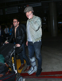 Just like us Celebs with injuries and broken bones