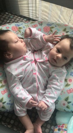 Conjoined Twins Defied Odds By Taking First Step And Living Their Best Life Conjoined Twins Defied Odds By Taking First Step And Living Their Best Life