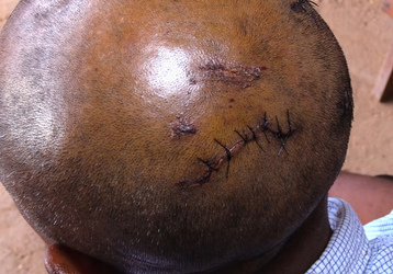 CLAW BLIMEY Horrific Injuries Of Man Who Grappled With Wild Jaguar To Save Nephews