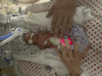 I THOUGHT MY BABY WAS GOING TO DIE WHEN MY WATERS BROKE AT 16 WEEKS