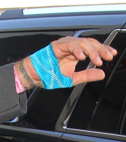Just like us Celebs with injuries and broken bones