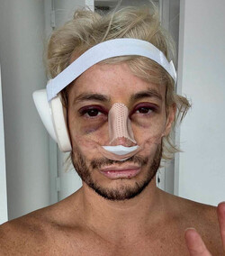 Celebs share their health issues on socials