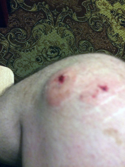 DiCaprio Lookalike Bitten By Suspected Junkie