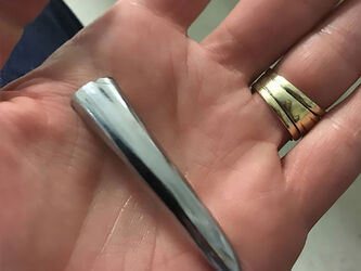 Docs Save Sight Of Boy 8 After Horrific Freak Accident