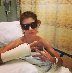 Just like us Celebs with injuries and broken bones