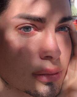  I m a real life ELF and have spent &pound;61 000 on my body transformation including eye colour change and skin whitening 