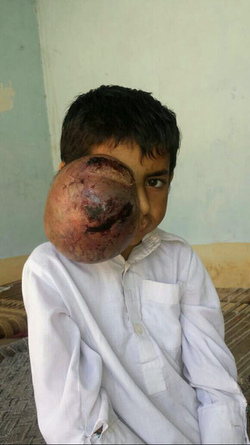 PAKISTANI PARENTS JOY AFTER BOXER AMIR KHAN COMES FOR HELP TO THEIR SEVEN YEAR OLD SON WITH ENORMOUS TUMOUR