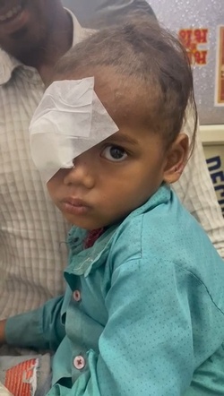 Boy three has WORM removed from his eye after it crawled inside Boy three has WORM removed from his eye after it crawled inside