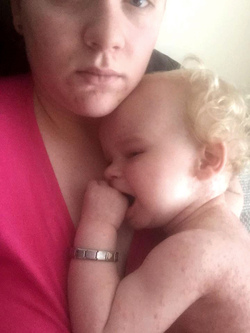 MOTHER SPEAKS OUT AFTER HER SON CONTRACTED THE HERPES VIRUS THROUGH A KISS