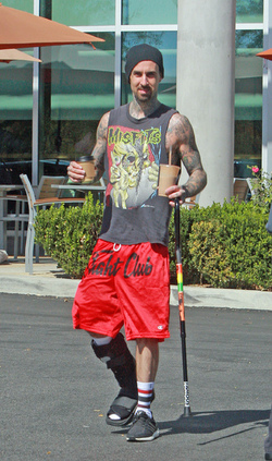 Just like us Celebs with injuries and broken bones