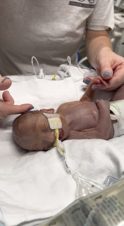 I THOUGHT MY BABY WAS GOING TO DIE WHEN MY WATERS BROKE AT 16 WEEKS