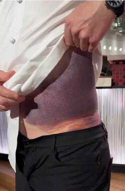 Celebs share their health issues on socials