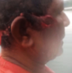 CLAW BLIMEY Horrific Injuries Of Man Who Grappled With Wild Jaguar To Save Nephews