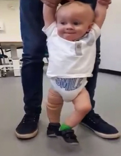 Tyson Fury Signed My Prosthetic Leg Tyson Fury Signed My Prosthetic Leg