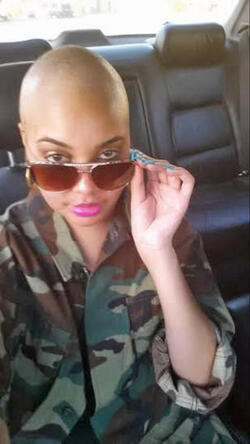 DANCER WHO FOUND CANCER WITH HELP OF SOCIAL MEDIA CELEBRATES REMISSION