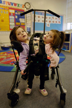 Conjoined Twins Defied Odds By Taking First Step And Living Their Best Life Conjoined Twins Defied Odds By Taking First Step And Living Their Best Life