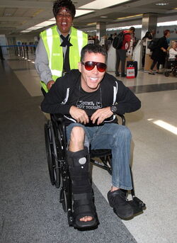 Just like us Celebs with injuries and broken bones