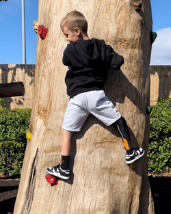 Tyson Fury Signed My Prosthetic Leg Tyson Fury Signed My Prosthetic Leg