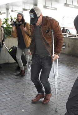 Just like us Celebs with injuries and broken bones