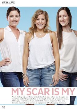 My Scar Is My Story