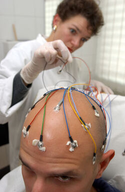 Epilessia
