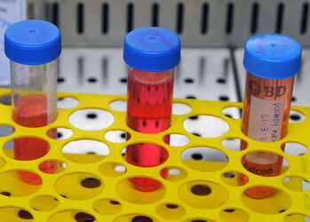 Bellinzona Andrea Alimonti ricercatore IOSI