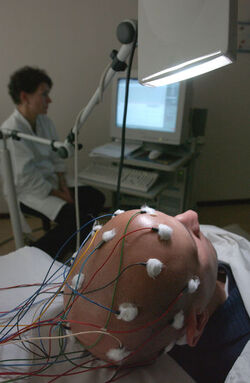 Epilessia